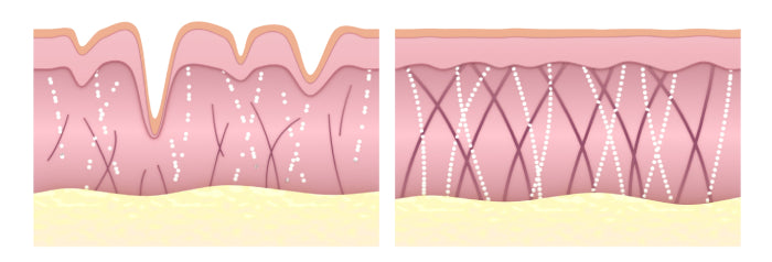 Are microcurrent devices worth spending on? 3 dermatologists weigh in